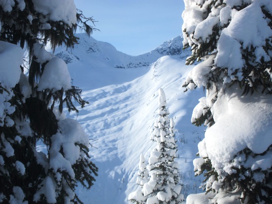 Gorgeous views of skiable terrain